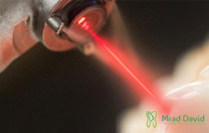 taschendesinfektion mittels laserlichttherapie